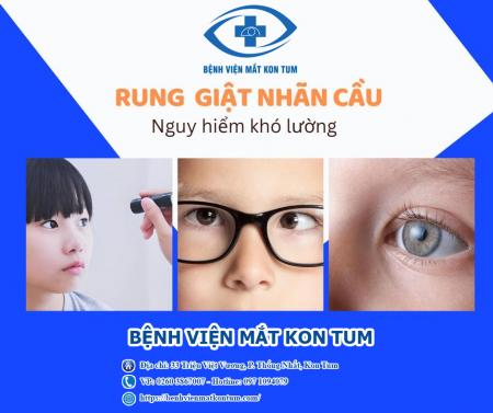 Rung giật nhãn cầu: Phân loại, nguyên nhân và cách điều trị