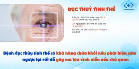 Tìm Hiểu Về: Đục Thuỷ Tinh Thể Cùng Bệnh Viện Mắt Kon Tum